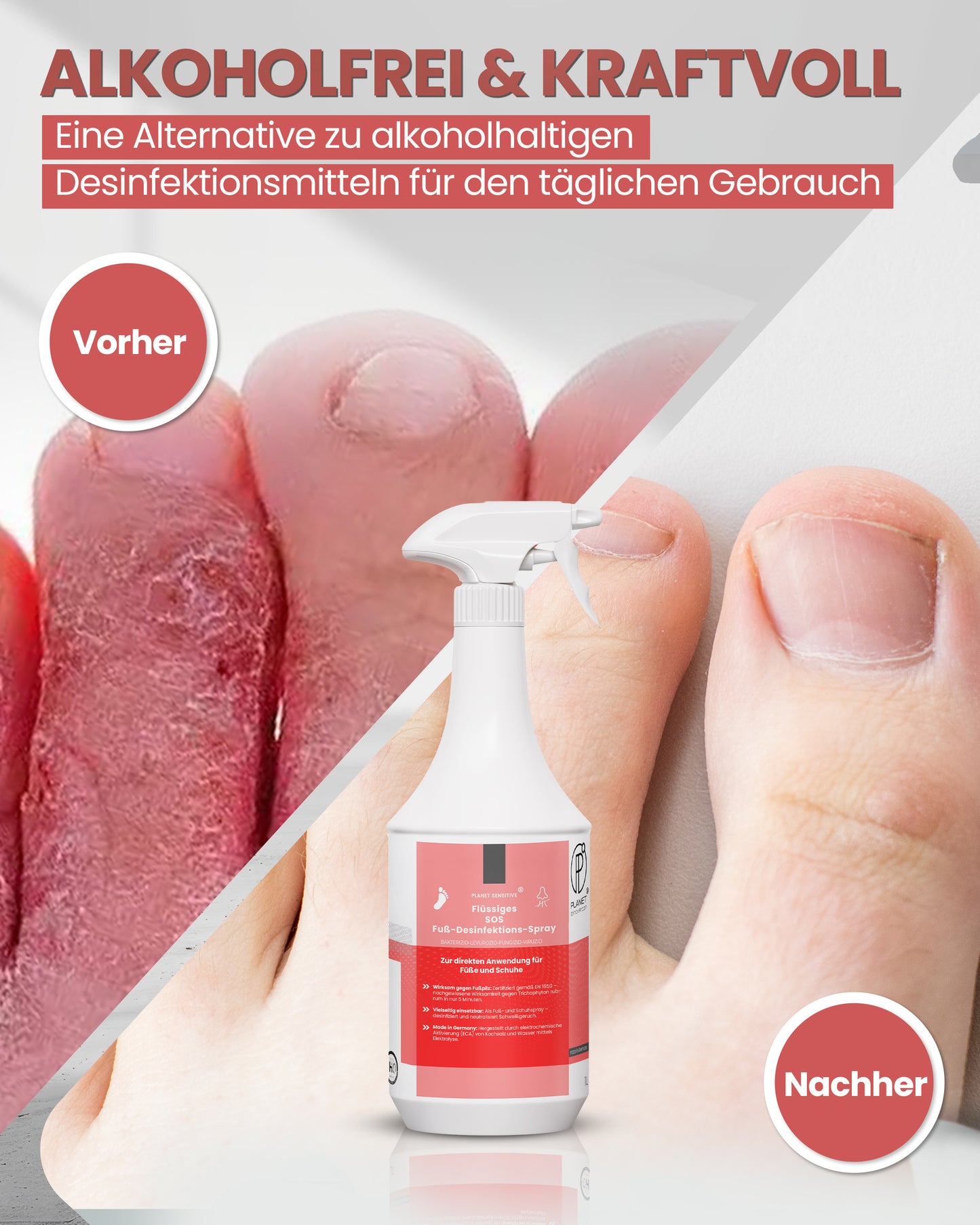 1L SOS Desinfektionsspray für Füße & Schuhe | Planet Sensitive® wirksam gegen Fußpilz, Bakterien, Viren, Hefepilze & Gerüche | Fuß-Desinfektion-Spray | Made in Germany