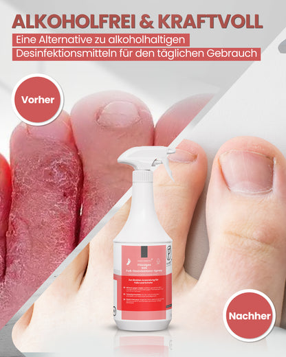 1L SOS Desinfektionsspray für Füße & Schuhe | Planet Sensitive® wirksam gegen Fußpilz, Bakterien, Viren, Hefepilze & Gerüche | Fuß-Desinfektion-Spray | Made in Germany